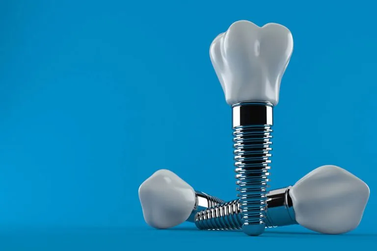 three dental implant models on a blue background