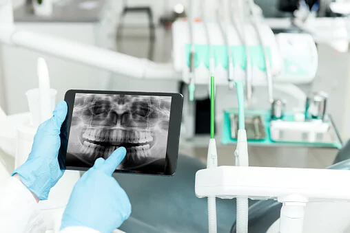 Dental professional holding a tablet displaying a panoramic dental X-ray image, with dental equipment and tools visible in the background.