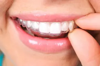 Tips for doing Invisalign treatments from LoPresti Dental in Stamford, CT